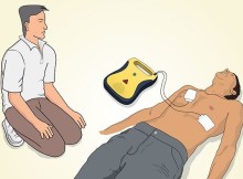 Uso-del-defibrillatore